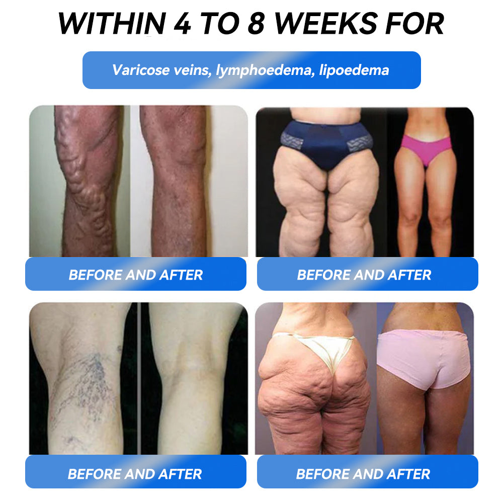 IFMAGIC® GLP-1 Pro Weight Loss Oral Solution👩‍⚕️One dose a day — see results in 7 days🔥Suitable for obesity, cardiovascular diseases, diabetes, sleep apnea, high cholesterol and blood lipids, joint problems, and various other conditions🌺