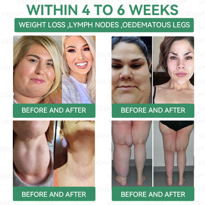 [𝑂𝑓𝑓𝑖𝑐𝑖𝑎𝑙 𝑆𝑡𝑜𝑟𝑒] 𝖵𝗌𝑜𝗑𝖺® 𝐺𝐿𝑃-1  𝑆𝑙𝑖𝑚𝑚𝑖𝑛𝑔 & 𝐻𝑒𝑎𝑙𝑡ℎ 𝑁𝑎𝑠𝑎𝑙 𝑅𝑖𝑛𝑔 🌱 𝐹𝑎𝑠𝑡 𝐹𝑎𝑡 𝐵𝑢𝑟𝑛 & 𝑀𝑒𝑡𝑎𝑏𝑜𝑙𝑖𝑐 𝐵𝑎𝑙𝑎𝑛𝑐𝑒