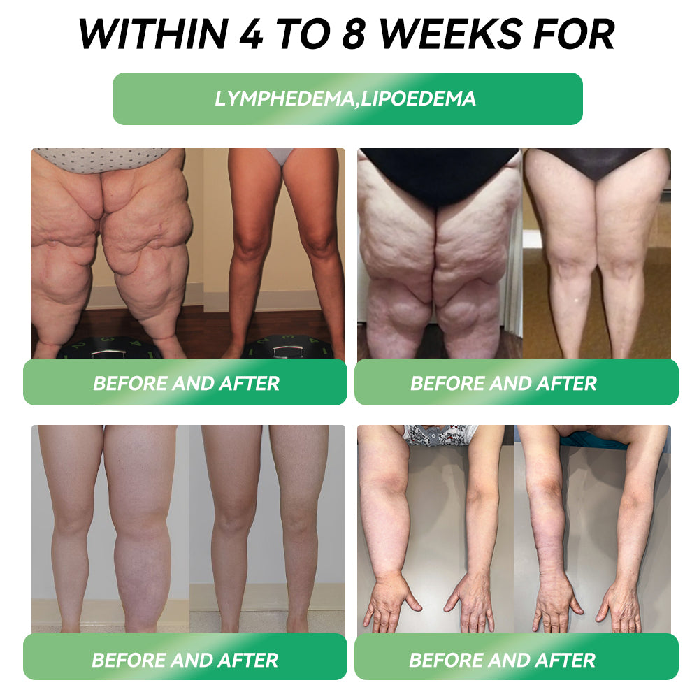 𝐑𝒆𝒔𝐮𝐥𝐭𝐬 𝒊𝒏 𝟕 𝐝𝒂𝐲𝐬✅𝐁𝐨𝒔𝒕𝗼𝗿𝗲® 𝐺𝑳𝐏 -1 𝐌𝐢𝐜𝒓𝒐𝒄𝒂𝒑𝘀𝘂𝗹𝗲 𝗕𝘂𝗿𝐬𝐭 𝑷𝒂𝙩𝙘𝙝 🌱