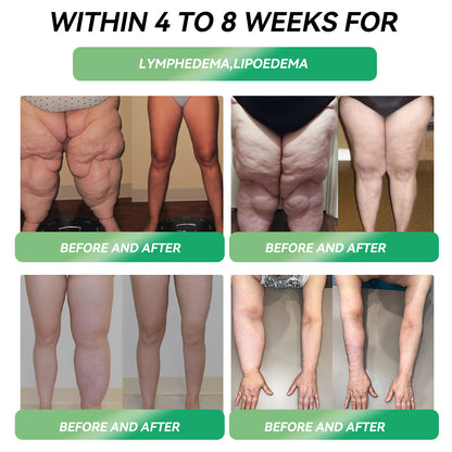 𝐑𝒆𝒔𝐮𝐥𝐭𝐬 𝒊𝒏 𝟕 𝐝𝒂𝐲𝐬✅𝐁𝐨𝒔𝒕𝗼𝗿𝗲® 𝐺𝑳𝐏 -1 𝐌𝐢𝐜𝒓𝒐𝒄𝒂𝒑𝘀𝘂𝗹𝗲 𝗕𝘂𝗿𝐬𝐭 𝑷𝒂𝙩𝙘𝙝 🌱